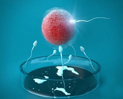 体外受精 IVF-ET